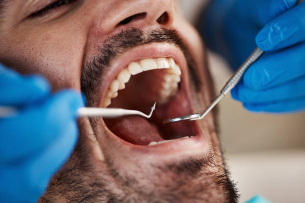 Best Oral Cancer Screening  in South Rosemary, NC